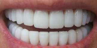 Continuous growth for the cryptocurrency of dentistry: two more dental clinics join dentacoin’s network